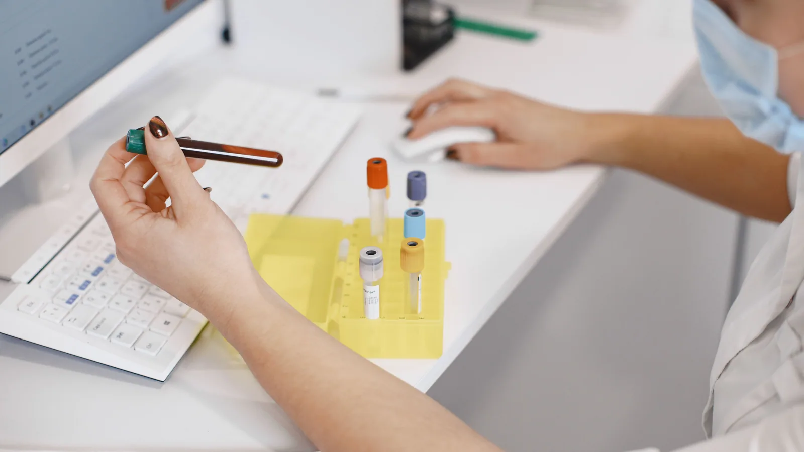 Probă de sânge manevrată într-un laborator medical